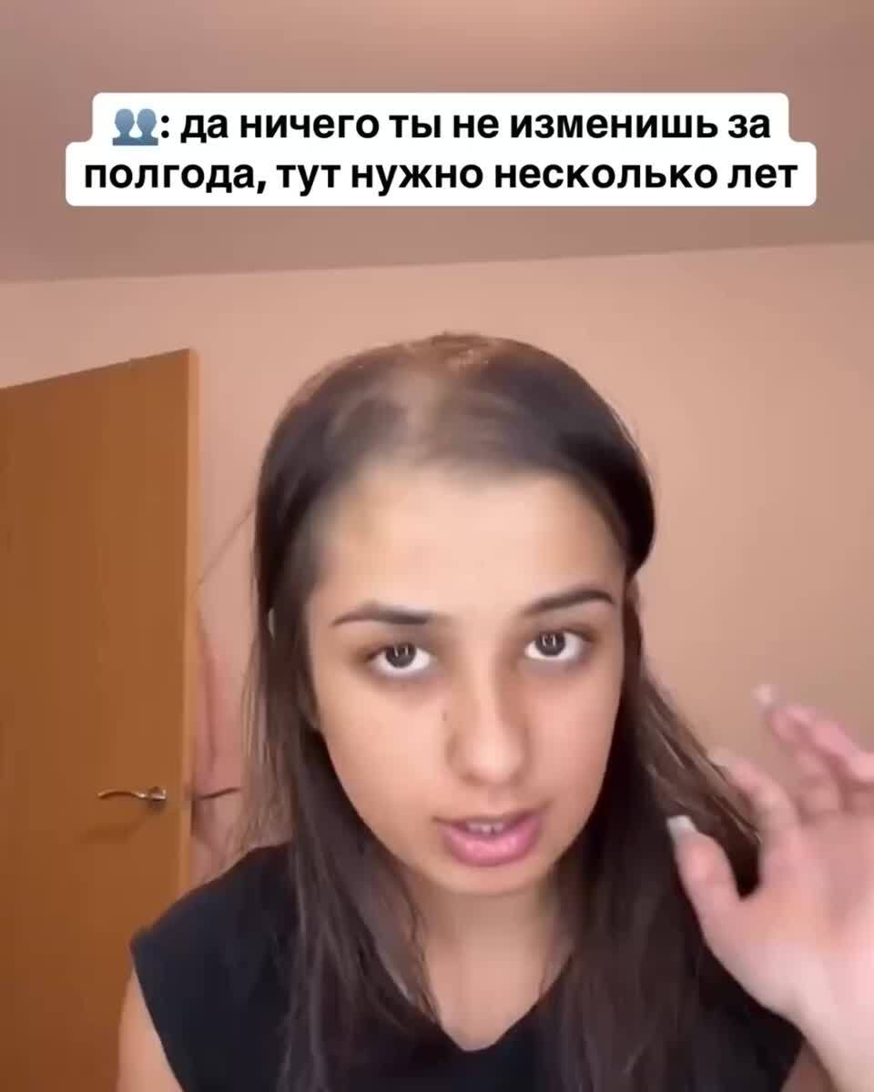 Смотри, что нашла на WB🥹🔥Сыворотка бустер для роста волос с биотином - https://wildberries.ru/catalog/0/search.aspx?search=WW407258OZON - https://ozon.ru/t/5U1kyxh✔️Подходит для всех типов волос, борится против облысения и алопеции.✔️Без масел и силиконов